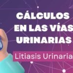 Cálculos En Las Vías Urinarias: Litiasis Urinaria