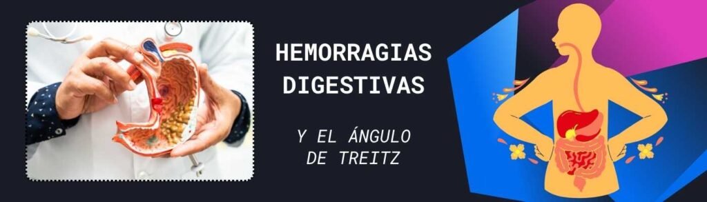 Hemorragias Digestivas Y El Ángulo De Treitz