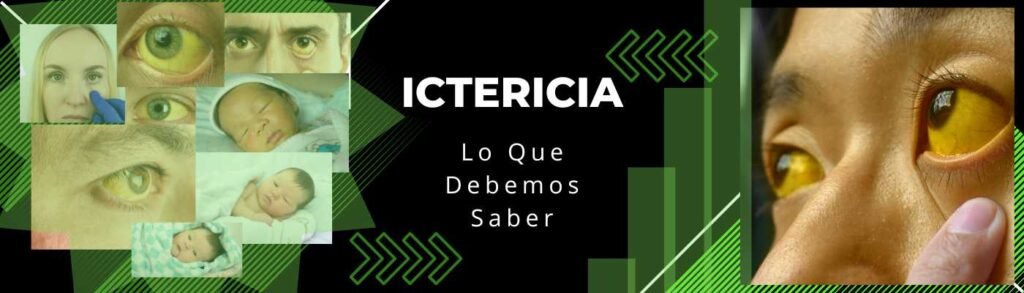 Ictericia: Lo Que Debemos Saber